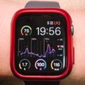 私がApple Watch Series 6で気に入っている画面やバンド、ケース等のアクセサリーをご紹介